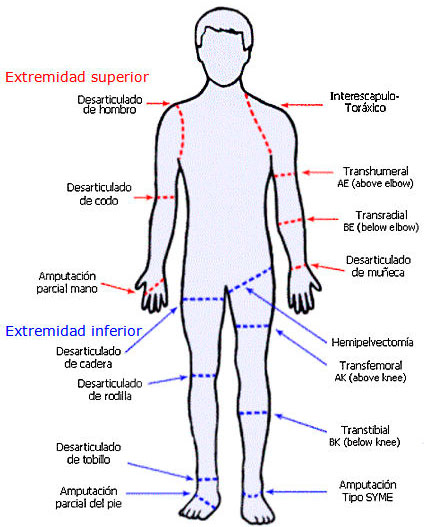 lesionesgravesamputacion rdi 03